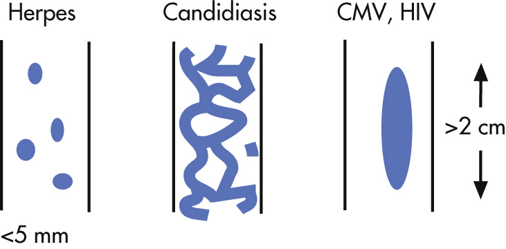 FIG. 3.8