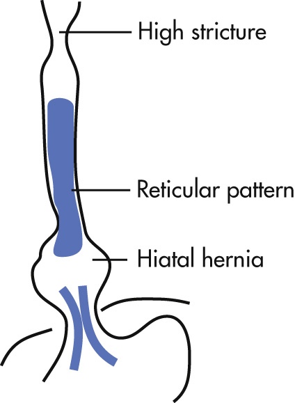 FIG. 3.9