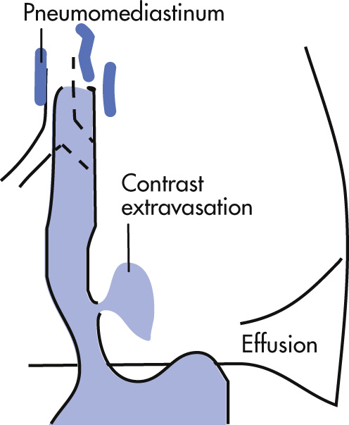 FIG. 3.10