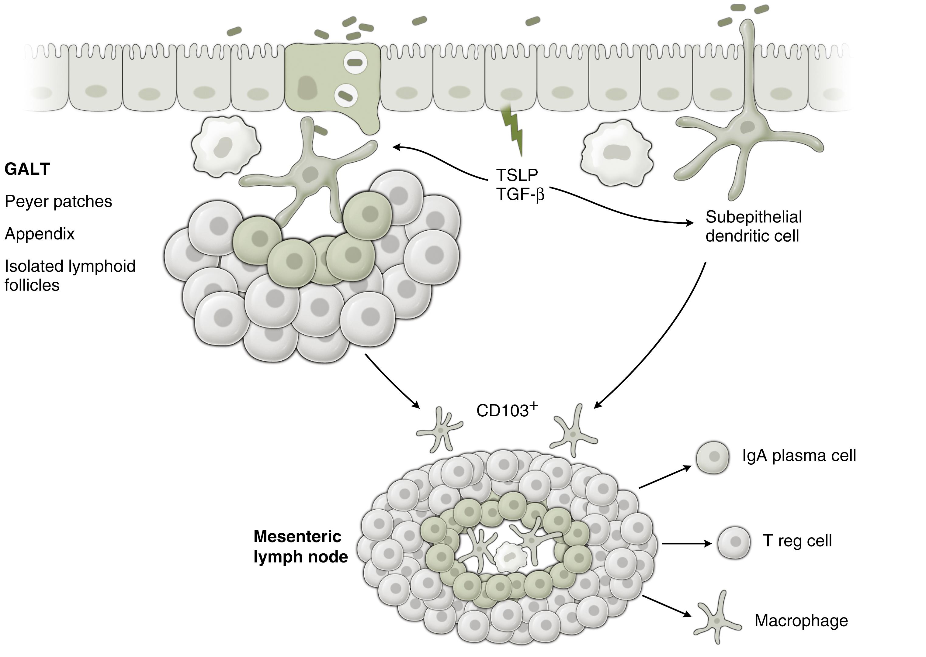 Fig. 5.1, Uptake of bacteria or dietary antigens by dendritic cells. This can occur (see left ) through M cells (epithelial cells) above organized gut-associated lymphoid tissue (GALT) follicles. Dendritic cells may also sample luminal antigen directly (see right ) by extending processes between enterocytes. Dendritic cells, sometimes carrying intracellular or surface sequestered bacteria, migrate to the mesenteric lymph nodes. Production of mediators such as thymic stromal lymphopoietin (TSLP) and transforming growth factor-β (TGF-β) induces a shift in dendritic cell phenotype to express CD103. These CD103+ cells in turn condition T cells in the mesenteric lymphoid follicle toward T REG status and B cells toward immunoglobulin A (IgA) . Conditioned cells then migrate from the mesenteric lymph nodes into the circulation expressing the gut-homing α4β7 integrin. These cells then re-enter the gut by binding to locally expressed MAdCAM-1. Macrophages and dendritic cells carrying bacteria leave in the same way, expressing the same homing marker. This is the basis of bacterial translocation into breast milk, as MAdCAM-1 expression is induced on mammary endothelium during lactation.