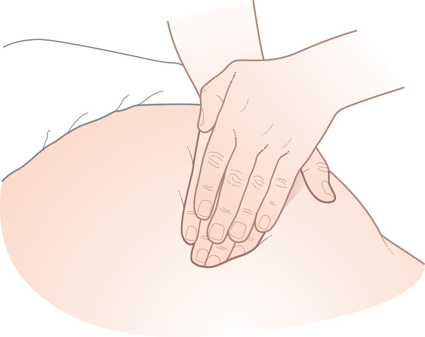 Figure 14.13, Method of deep palpation in an obese, muscular or poorly relaxed patient.