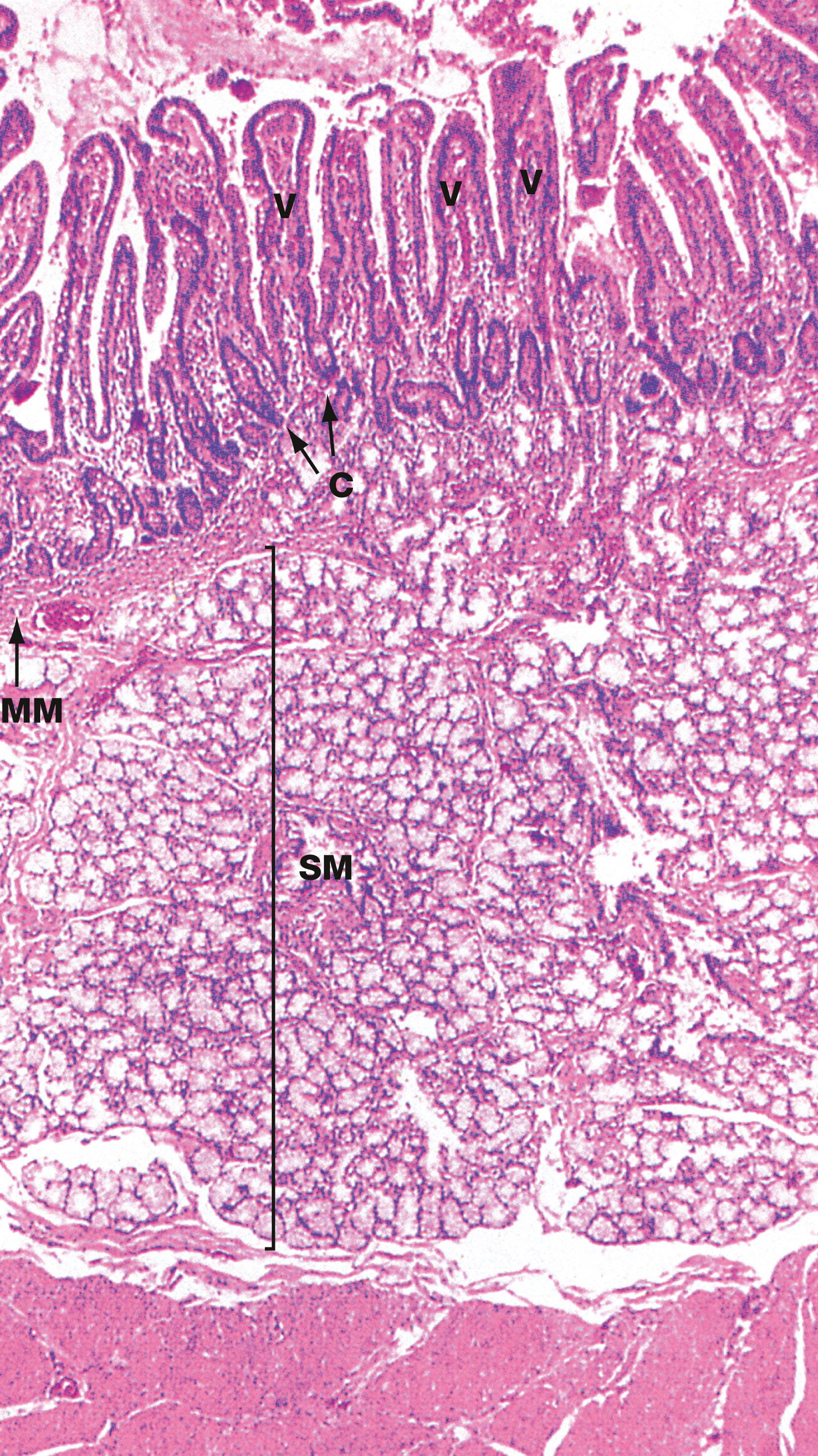 Fig. 14.17, Duodenum