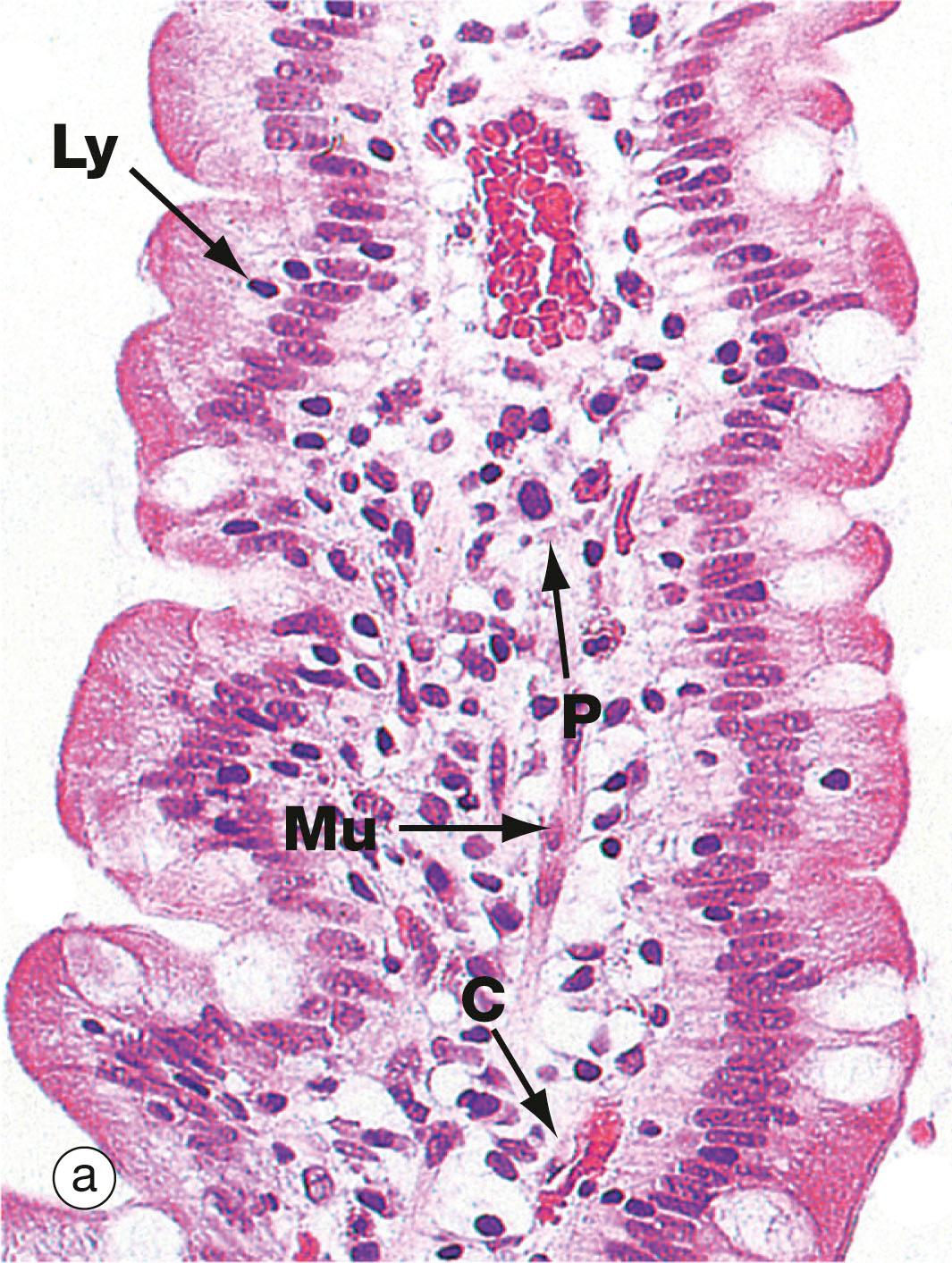 Fig. 14.22, Intestinal villi