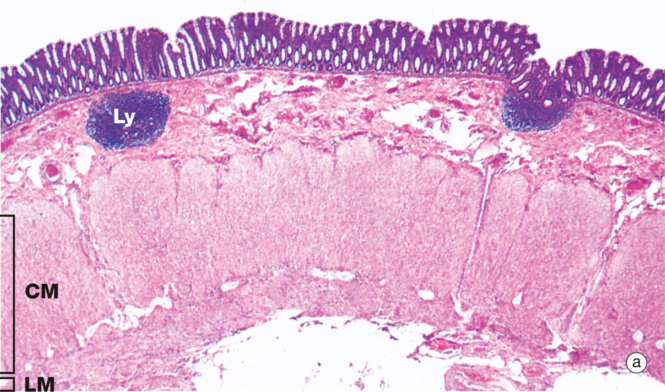 Fig. 14.29, Colon