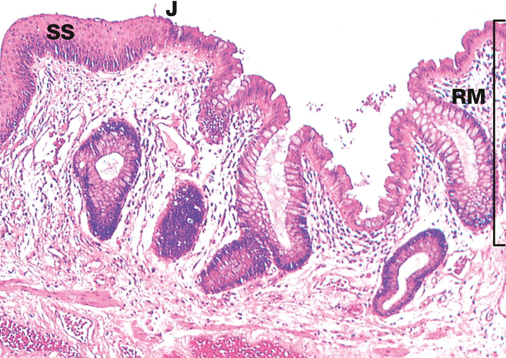 Fig. 14.32, Anorectal junction