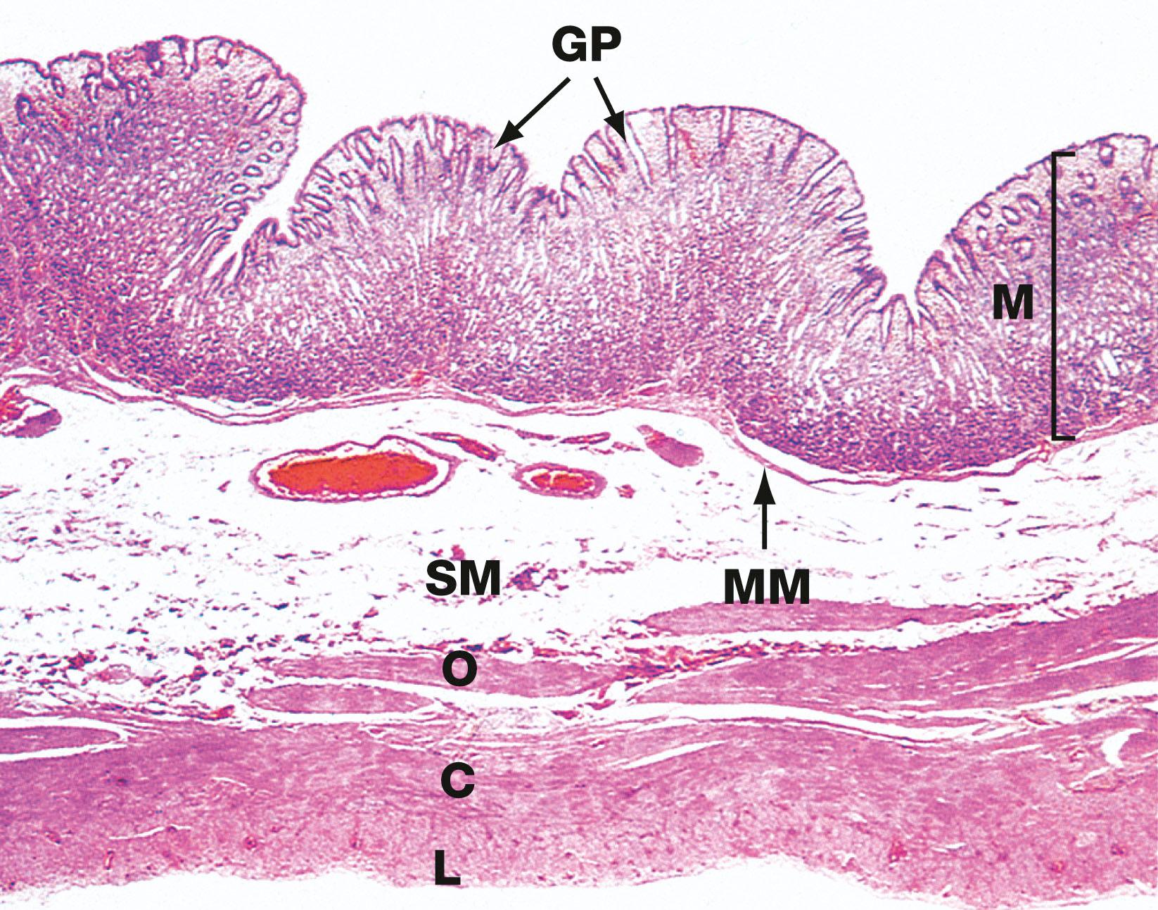 Fig. 14.8, Body of the stomach