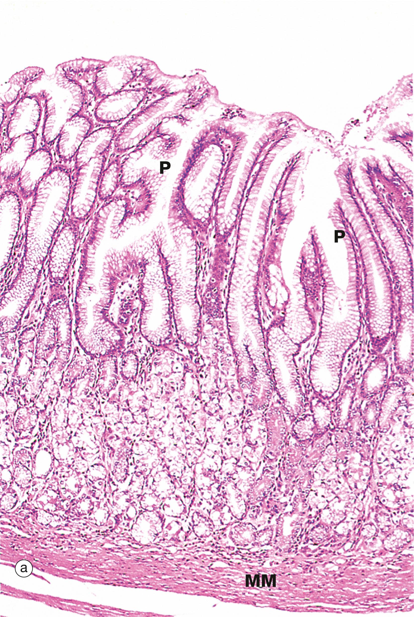 Fig. 14.14, Pyloric stomach