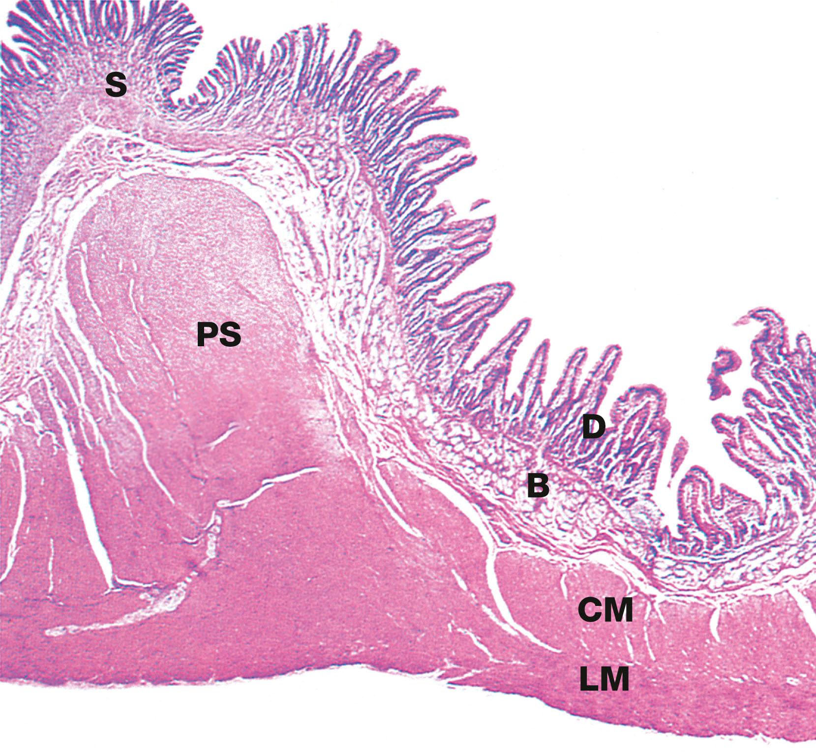 Fig. 14.15, Pyloric stomach