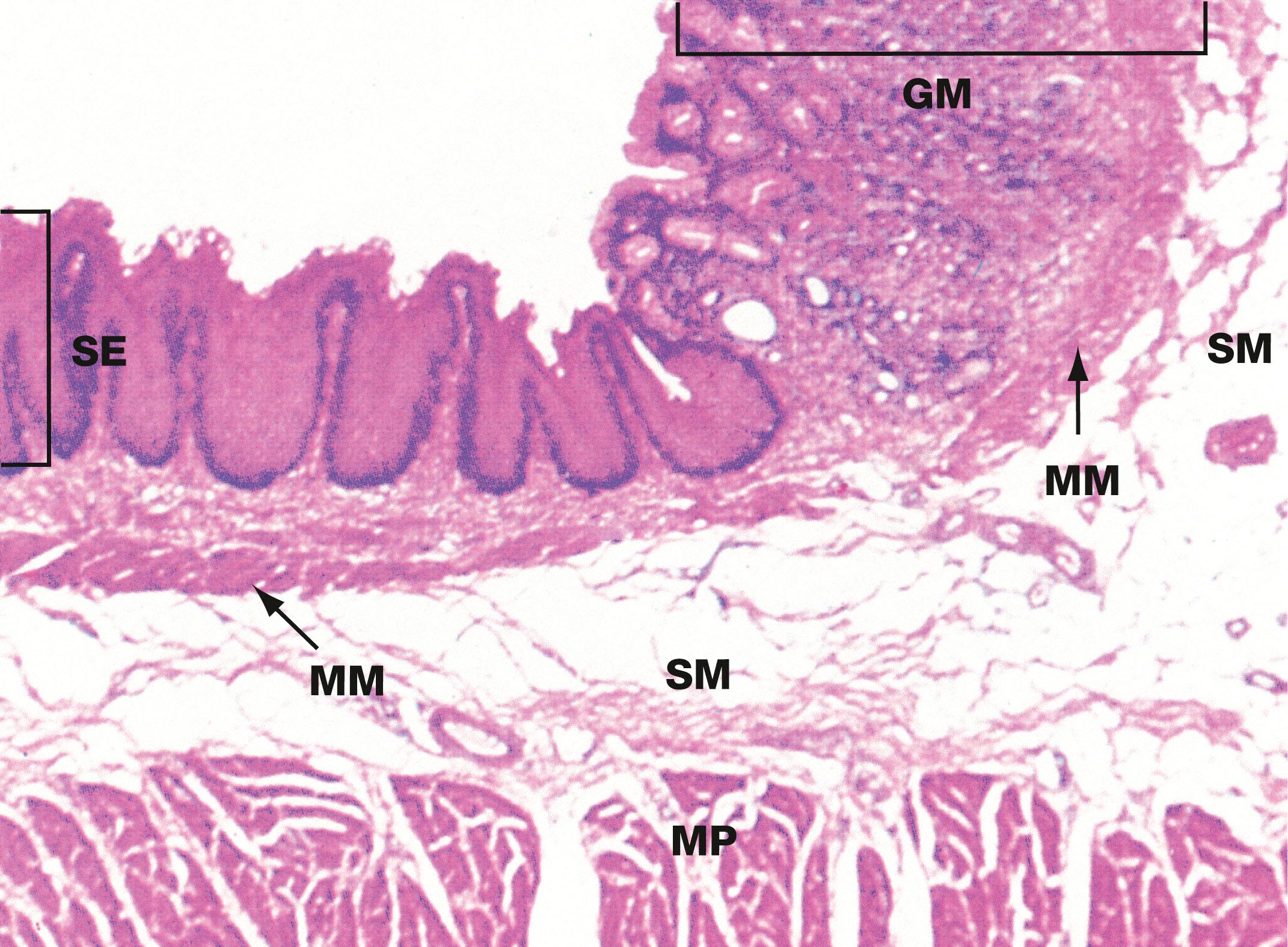 Fig. 14.6, Oesophago-gastric junction