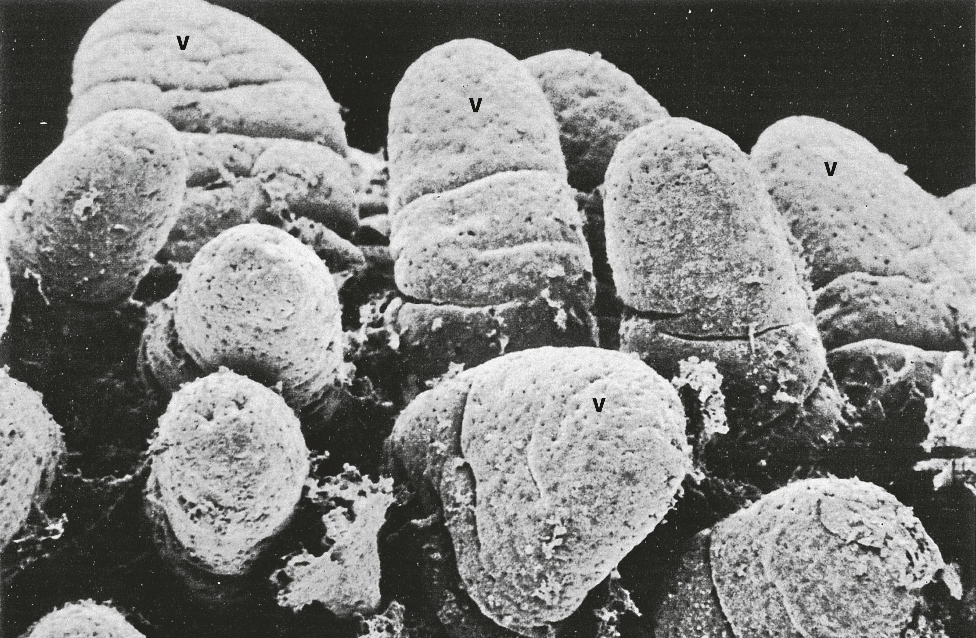 Fig. 14.21, Intestinal villi SEM ×100