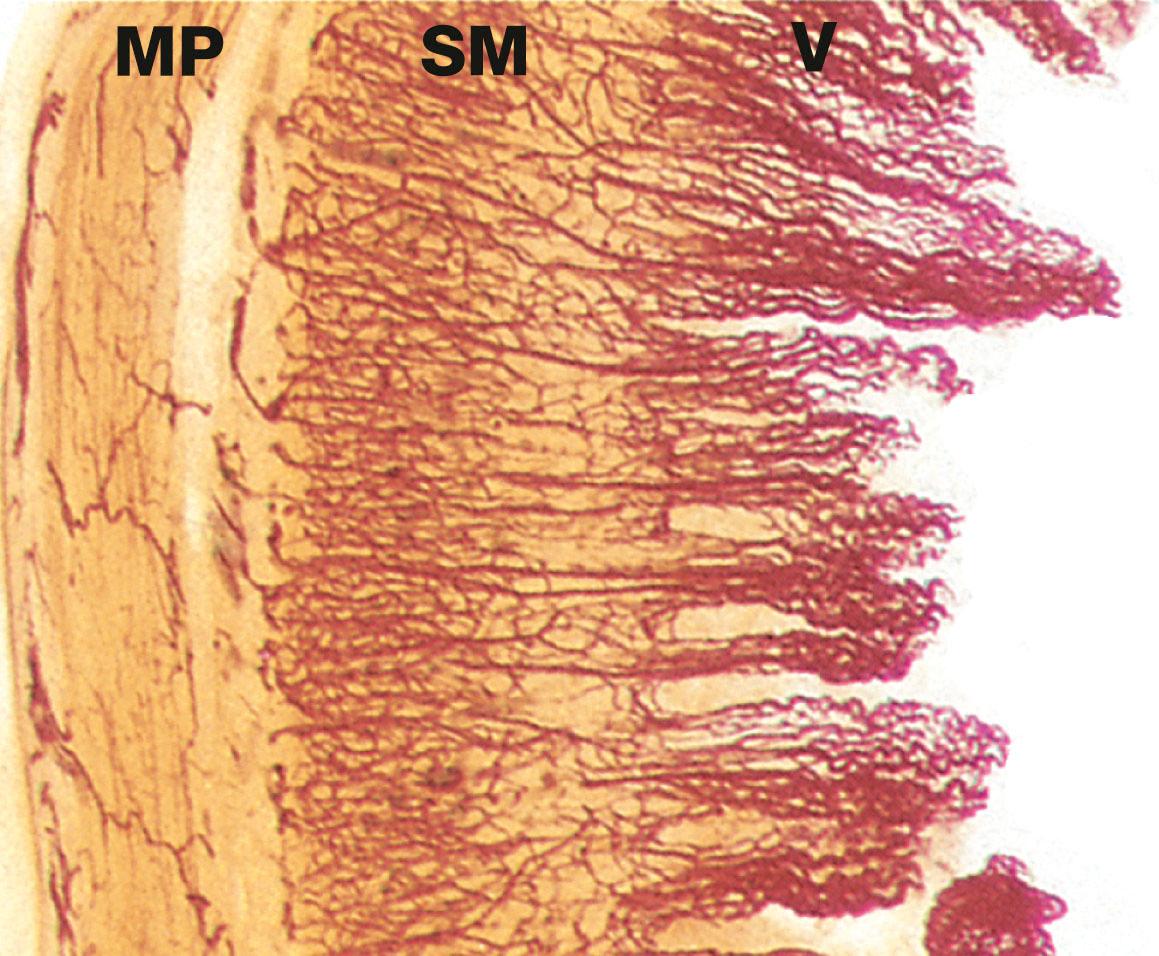 Fig. 14.27, Intestinal villi