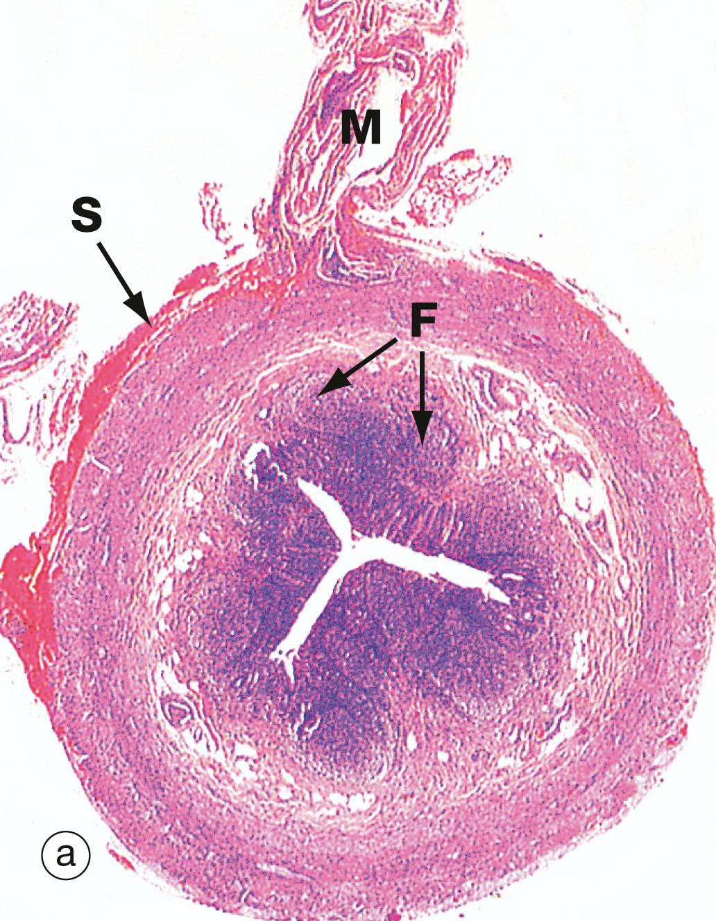 Fig. 14.31, Appendix