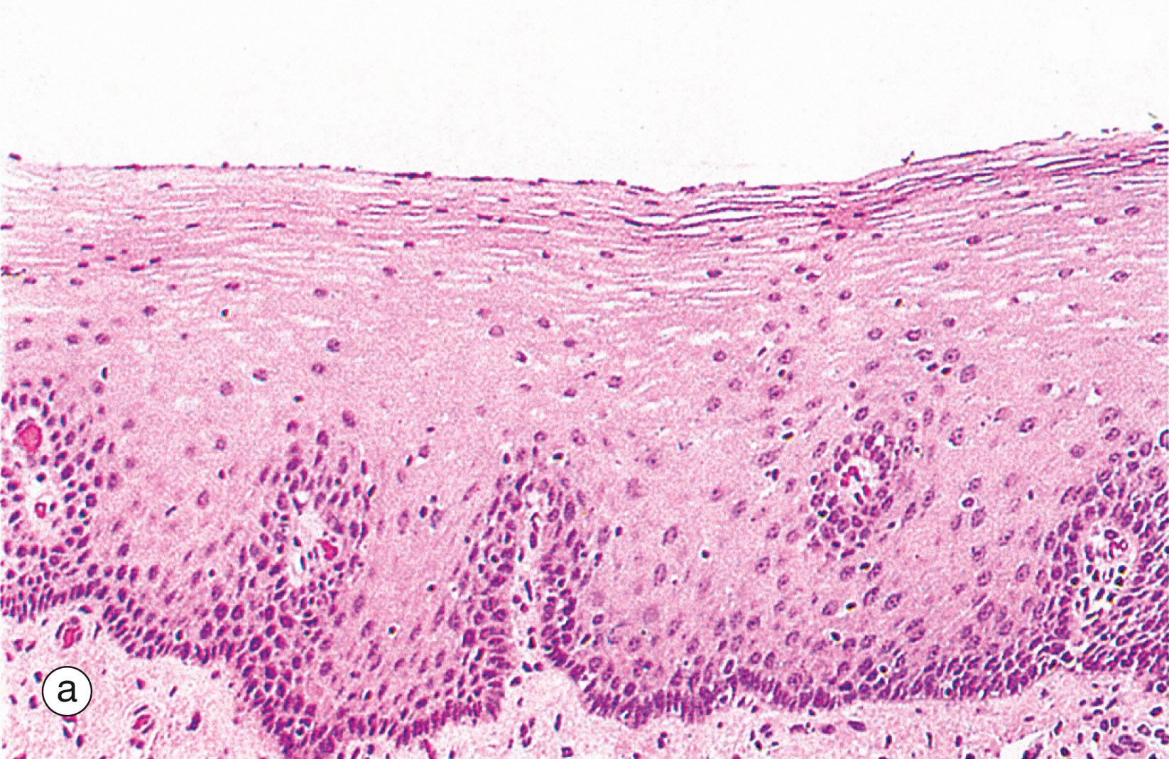 Fig. 14.3, Basic mucosal types in the gastrointestinal tract