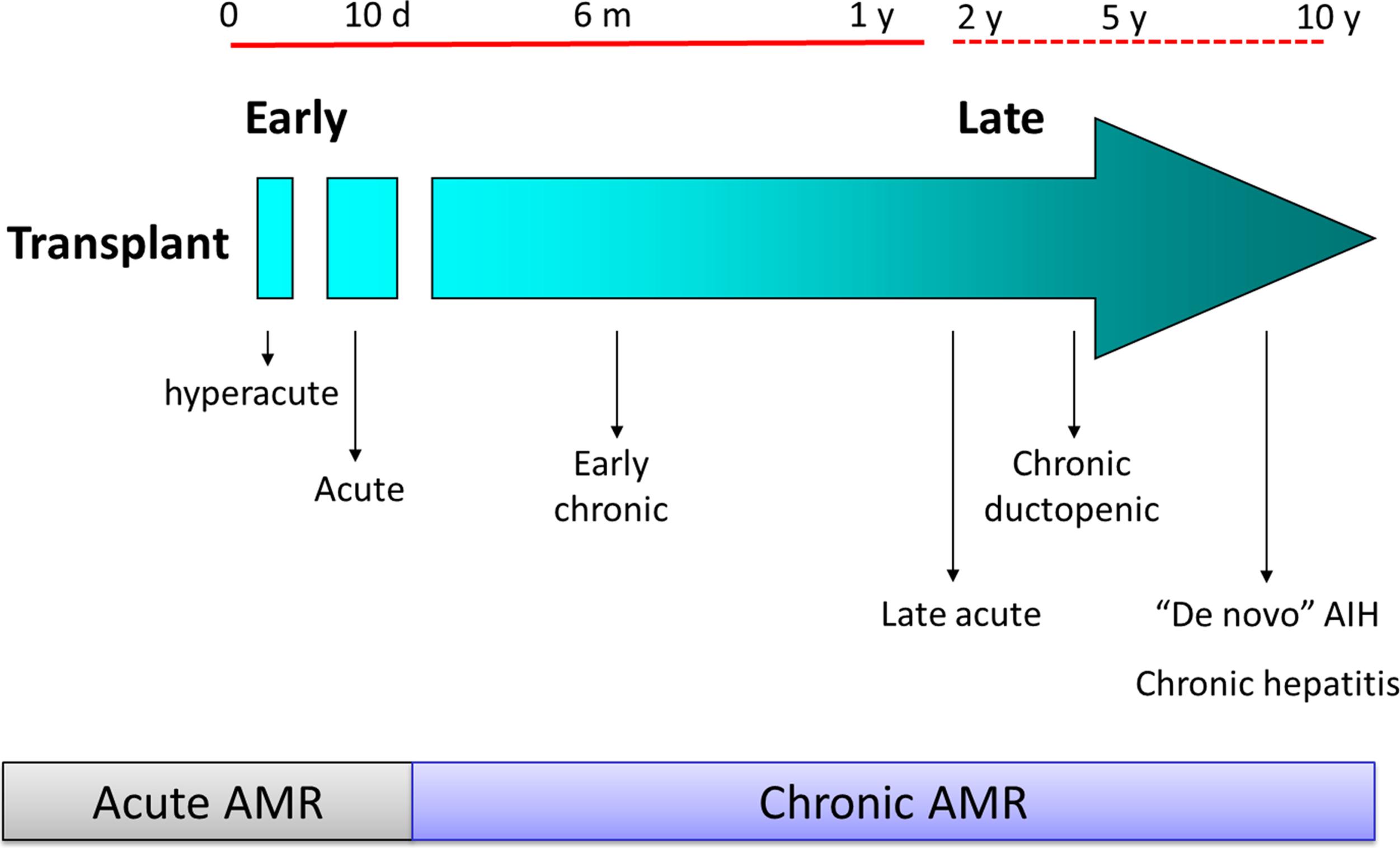 Fig. 22.2, Timing of different types of rejection after pediatric liver transplantation. AIH, Autoimmune hepatitis; AMR, antibody-mediated rejection.