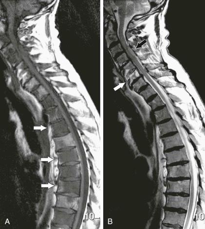 General Principles of MRI of the Bone Marrow - Clinical Tree