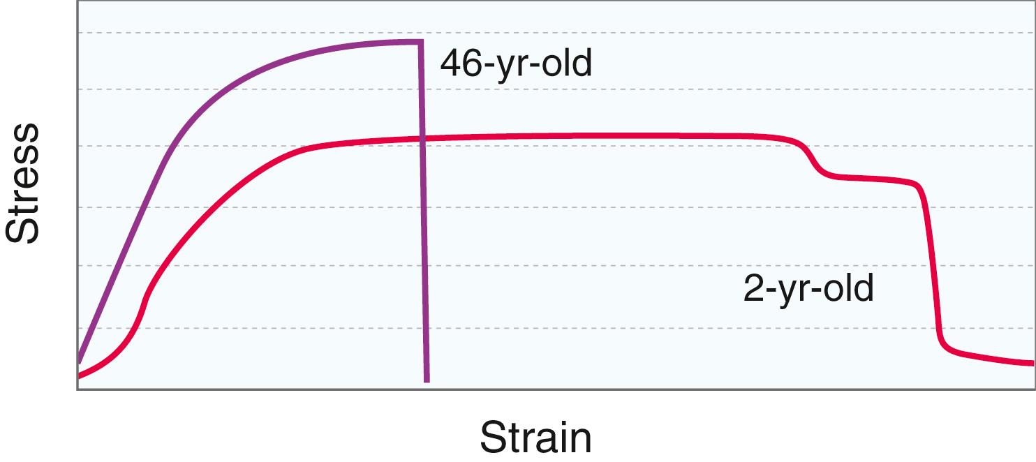 Fig. 27.1, Stress-strain curves for mature and immature bone. The increased strain of immature bone before failure represents plastic deformation.