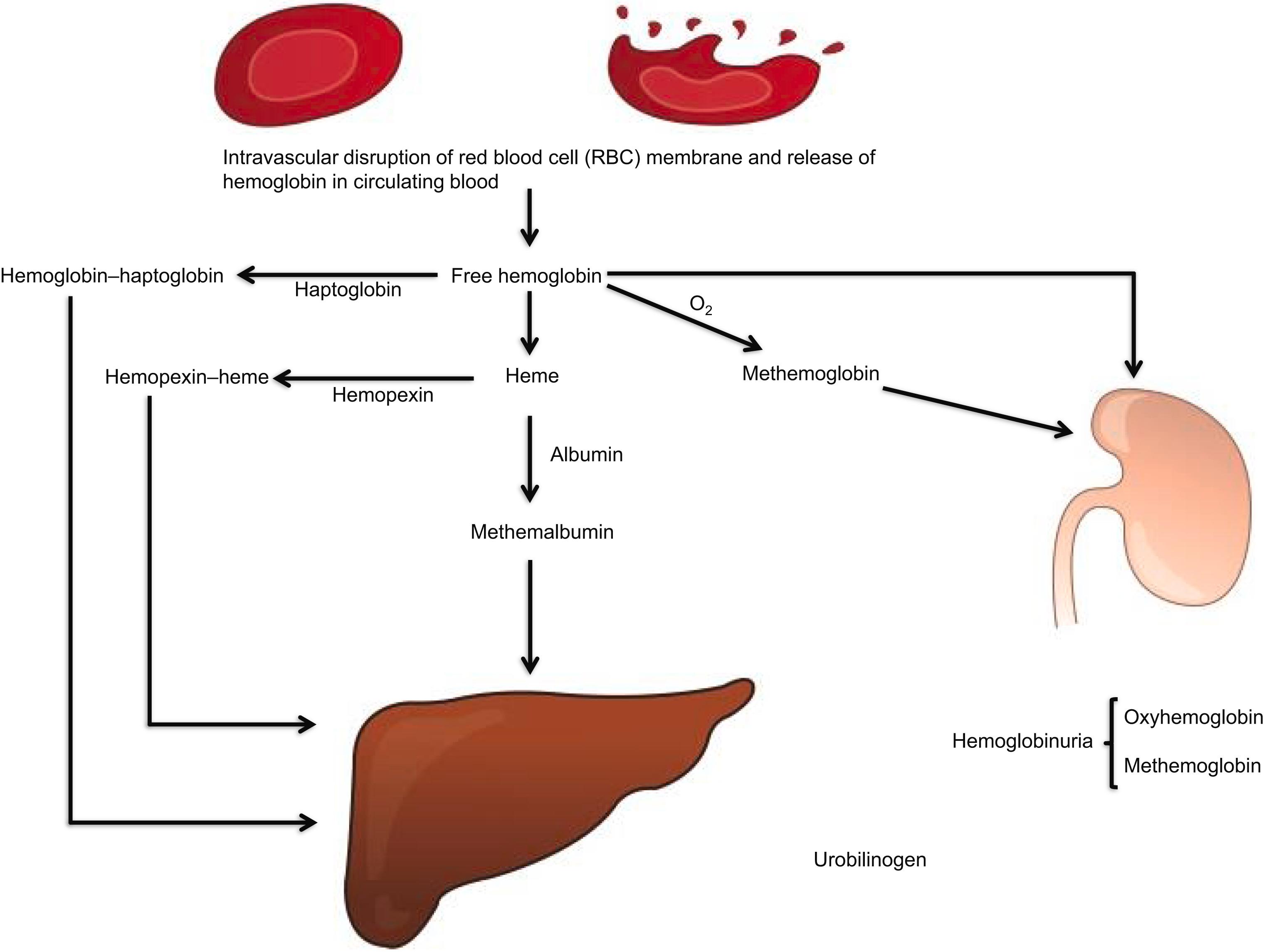 Figure 7.2, Intravascular hemoglobin catabolism following intravascular hemolysis. Hemoglobin–haptoglobin, hemopexin–heme, and methemalbumin are cleared by hepatocytes. Heme is converted to iron and bilirubin. The common pathway for both extravascular and intravascular hemolysis is the conjugation of bilirubin (bilirubin glucuronide) by the hepatocytes, its excretion in bile and ultimately formation of urobilinogen by the bacteria in the gut. Part of urobilinogen enters the enterohepatic circulation and part is excreted by the kidney in urine, and the remainder of urobilinogen is excreted in stool.
