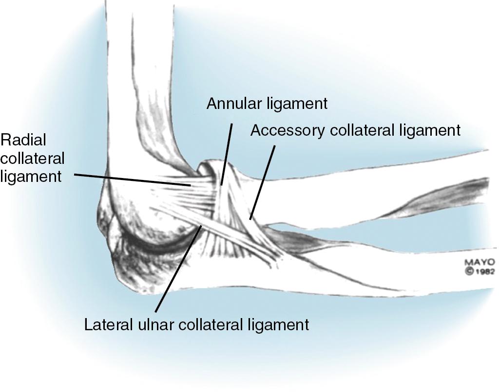 Fig. 42.7, Radial collateral ligament complex demonstrating the Y configuration. Lateral clinical instability involves the radial collateral ligament, which travels from the humerus to the annular ligament.