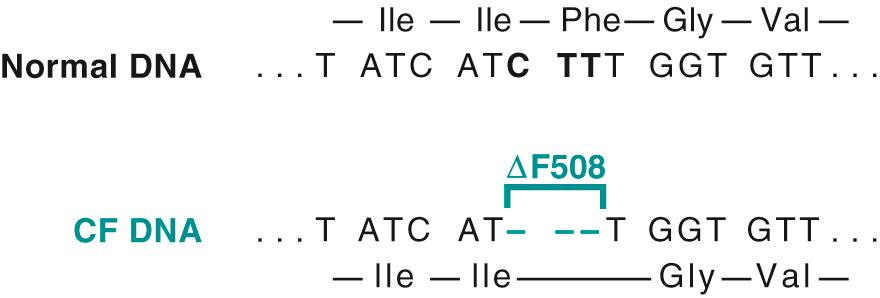 Figure 5.2, Three-base deletion in the common cystic fibrosis (CF) allele results in synthesis of a protein that lacks amino acid 508 (phenylalanine). Because the deletion is a multiple of three, this is not a frameshift mutation.