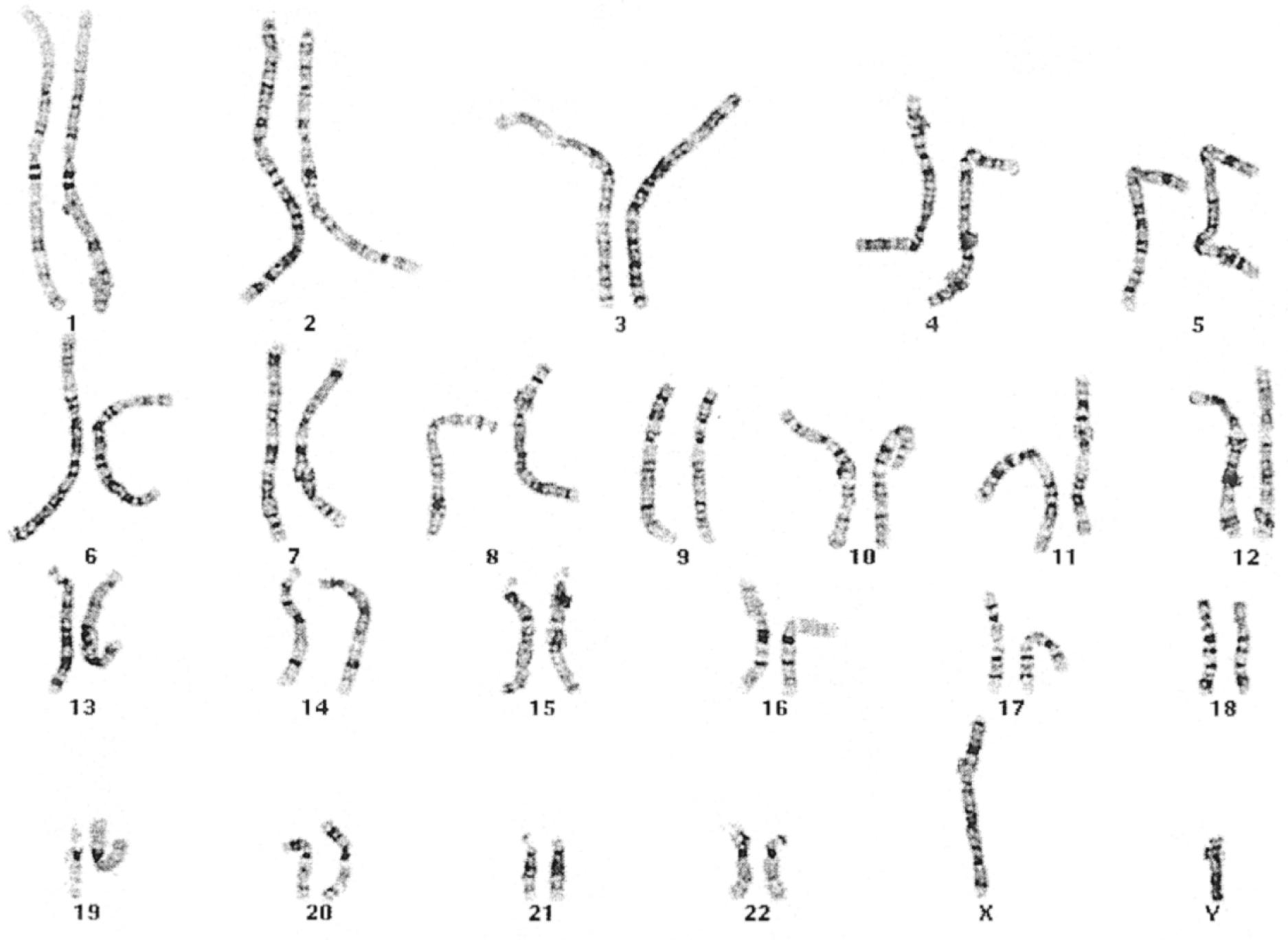 Fig. 1.4, G-banded male karyotype. A female would have two X chromosomes and no Y chromosome. The horizontal banding produced by the Giemsa staining technique allows for precise identification of homologous chromosomes.