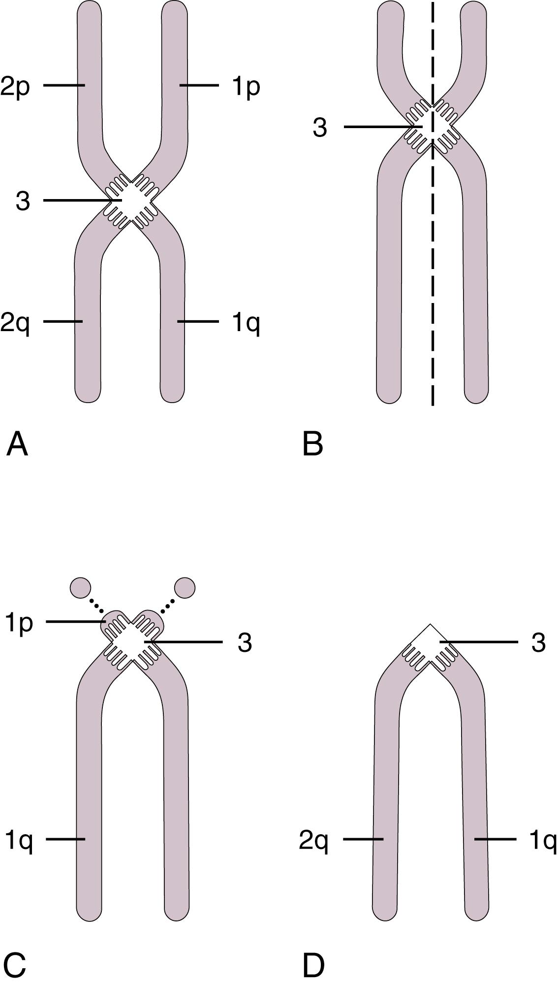 Fig. 1.5, Morphology of a chromosome during metaphase. (A) Metacentric chromosome with centromere (3) in the middle. (B) Submetacentric chromosome with centromere off-center. (C) Acrocentric chromosome with centromere near one end. (D) Telocentric chromosome (not found in humans) with centromere at one end. The deoxyribonucleic acid of the chromosome has replicated to form two chromatids: 1p and 1q represent one complete chromatid, 2p and 2q the other complete chromatid ( p refers to the short arm and q refers to the long arm). The chromosome will then divide longitudinally, as shown in (B).