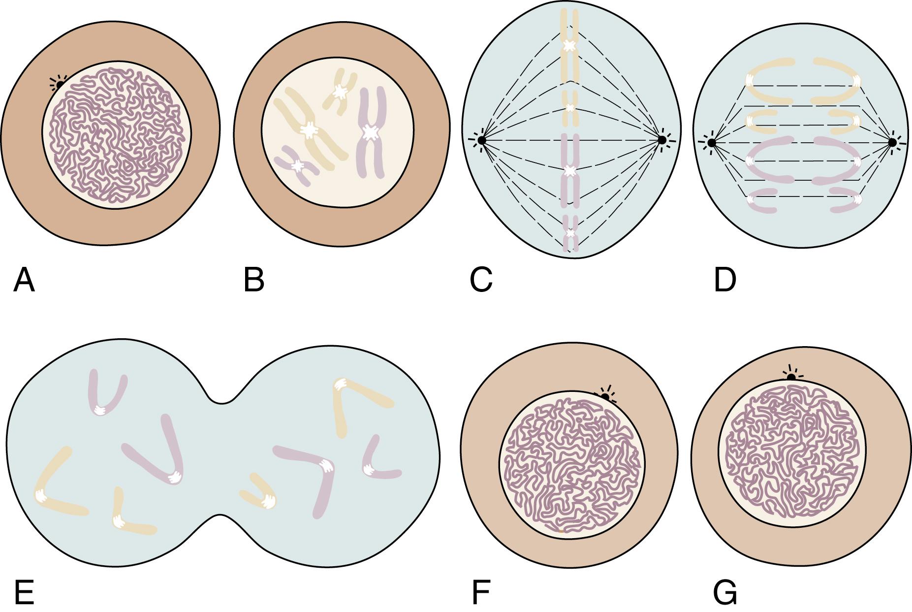 Fig. 1.7, Mitosis lasts about 1 hour, during which time the cell divides. (A) Interphase cell at the end of G 2 . (B) Prophase: Replicated DNA condenses and is visible. (C) Metaphase: 46 duplicated chromosomes align randomly on the spindle and can be photographed for karyotyping. (D) Anaphase: Chromosomes divide longitudinally, and half of each one moves to the opposite pole of the cell. (E) Telophase: Cell wall divides. (F and G) Interphase at G 1 : Two daughter cells, each with 46 chromosomes.