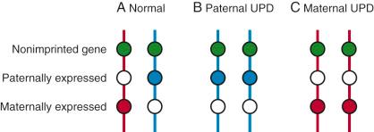 FIG 2-7, Genomic imprinting and uniparental disomy (UPD). Schematic of a hypothetical chromosome pair representing genomic imprinting. The maternal chromosome is indicated by the red line, and the paternal copy by the blue line. Genes are represented by circles: colored circles indicate genes that are expressed, and the white circles represent genes that are inactive. The green circles are genes that are not imprinted, whereas red circles indicate genes in which only the maternal copy is active and the blue circles genes in which only the paternal copy is active. A, Normal state, with one chromosome inherited from each parent. The nonimprinted gene is expressed from both parents, whereas only one copy of the red or blue (imprinted) gene is expressed. B, Paternal UPD. With two copies of the paternal chromosome present, there is a double dose of the paternally expressed (blue) gene, and absence of expression of the maternally expressed gene. C, Maternal UPD. There is an absence of paternally expressed gene product (blue) and a double dose of the maternally expressed products (red).