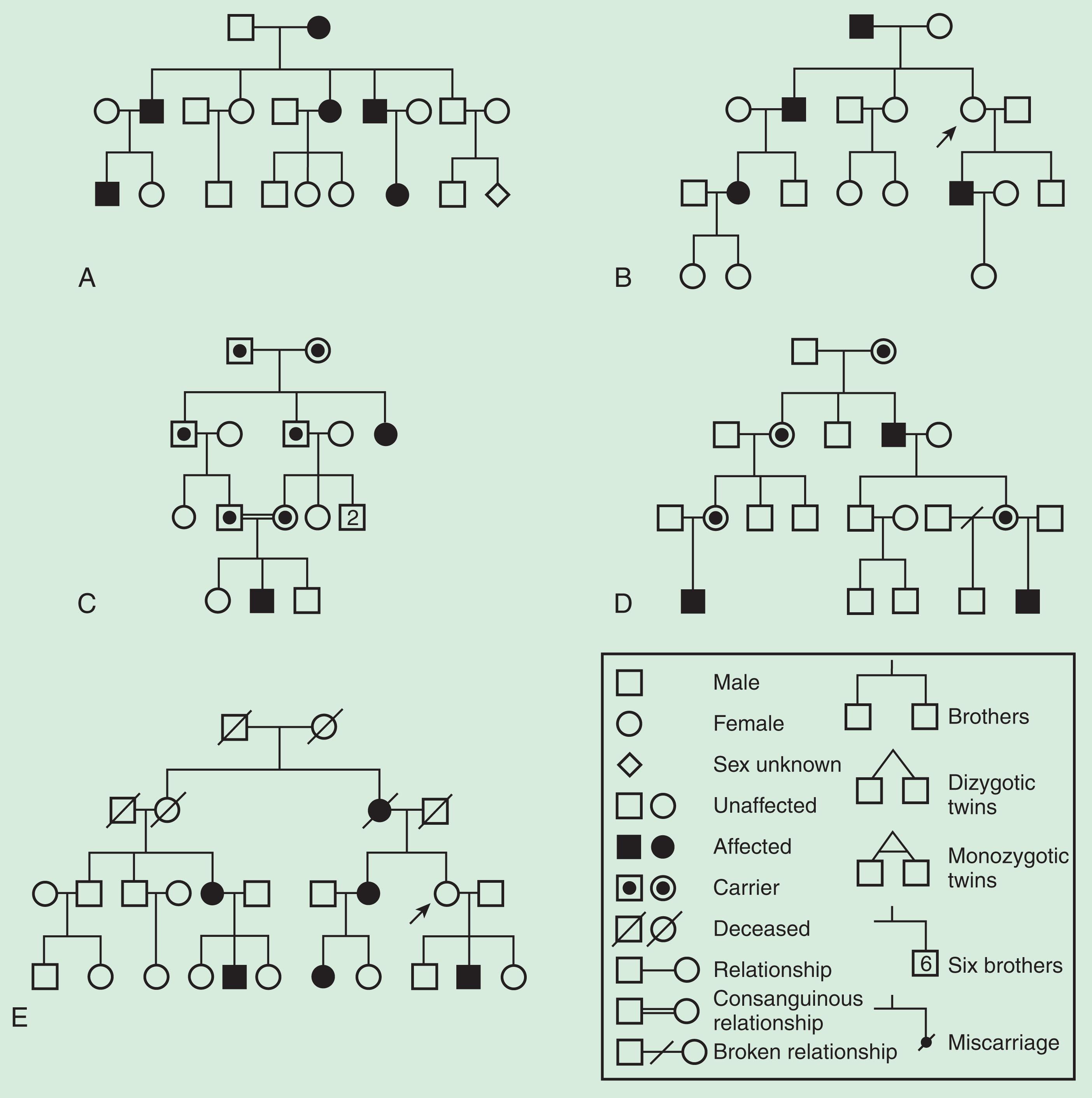 Fig. 10.2, Pedigree patterns of autosomal dominant (A,B), autosomal recessive (C), X-linked recessive (D), and mitochondrial (E) conditions. Arrows highlight non-penetrant carriers of an autosomal dominant (B) and a mitochondrial (E) disorder.