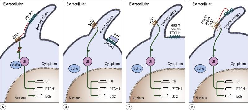 Figure 2.2, The hedgehog signaling pathway. A) Patched-1 that is not bound to its ligand, hedgehog, inhibits smoothened signaling. B) Upon binding hedgehog, patched-1-mediated repression of smoothened signaling is removed, resulting in the release of activating Gli transcription factors (Gli1, Gli2) from a cytosolic inhibitory complex with SuFu. The Gli transcription factors induce a cascade of gene expression in the nucleus. C) Inactivating mutations in patched-1 results in loss of smoothened repression and constitutive expression of Gli gene targets. D) Activating mutations in smoothened result in constitutive expression of Gli gene targets despite attempted repression by patched-1.