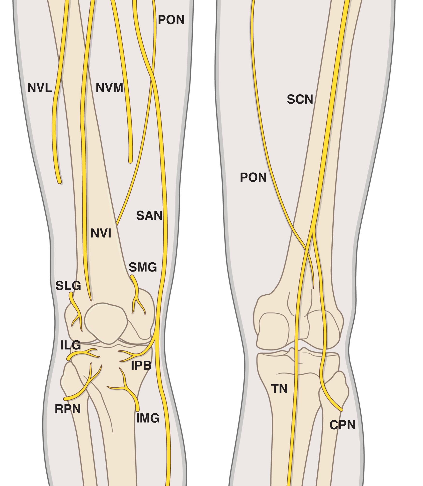 Figure 26.1, Schematic drawing of the innervation of the anterior (left) and posterior (right) aspects of the knee. CPN , Common peroneal nerve; ILG , inferior lateral genicular nerve; IMG , inferior medial genicular nerve; IPB , infrapatellar branch of the saphenous nerve; NVI , nerve to the vastus intermedius muscle; NVL , nerve to the vastus lateralis muscle; NVM , nerve to the vastus medialis muscle; PON , posterior branch of the obturator nerve; RPN , recurrent peroneal nerve; SAN , saphenous nerve; SCN , sciatic nerve; SLG , superior lateral genicular nerve; SMG , superior medial genicular nerve; TN , tibial nerve.