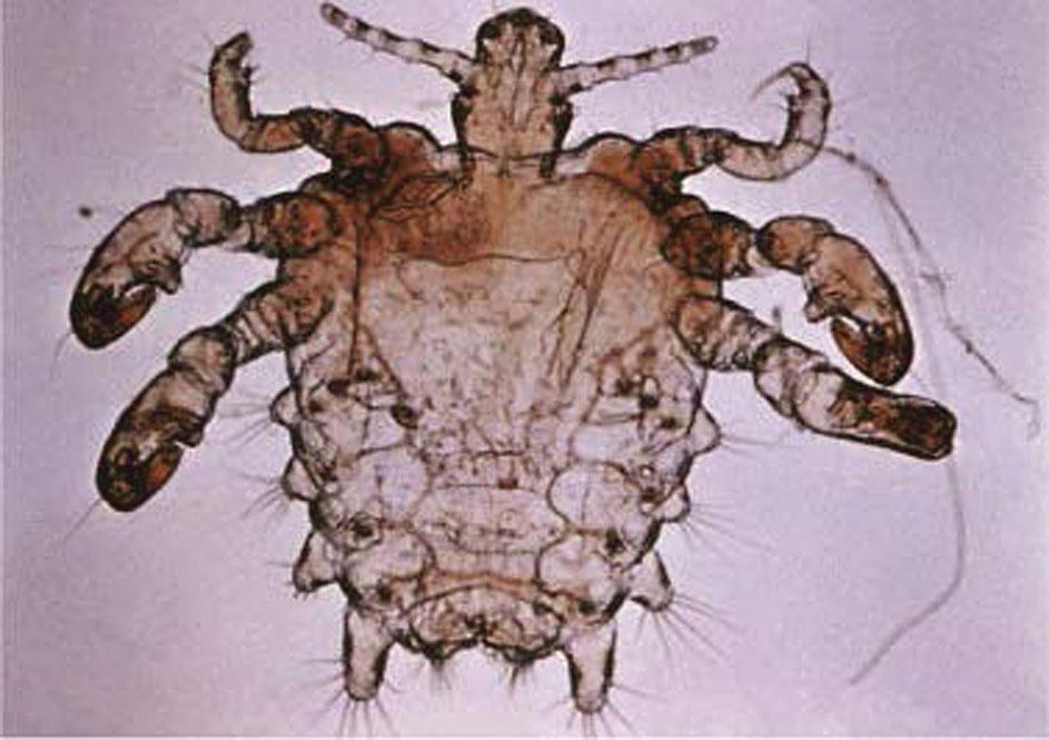 Fig. 23.4, Public louse.