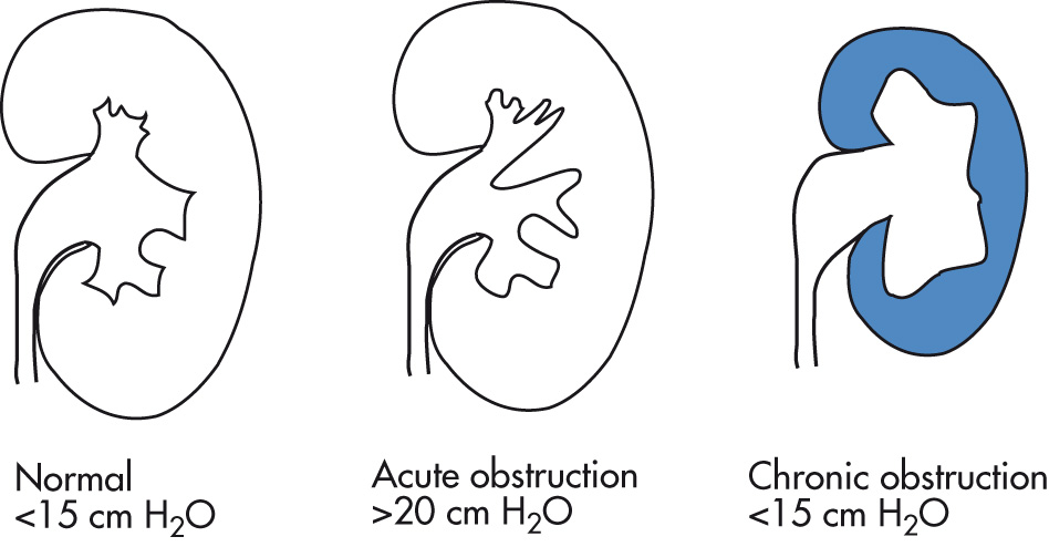 FIG. 4.12