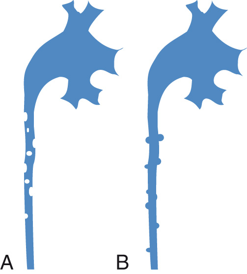 FIG. 4.16