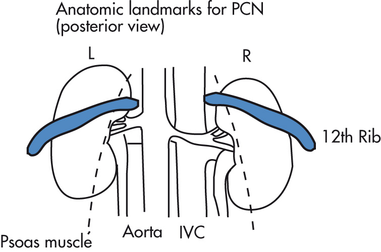 FIG. 4.2