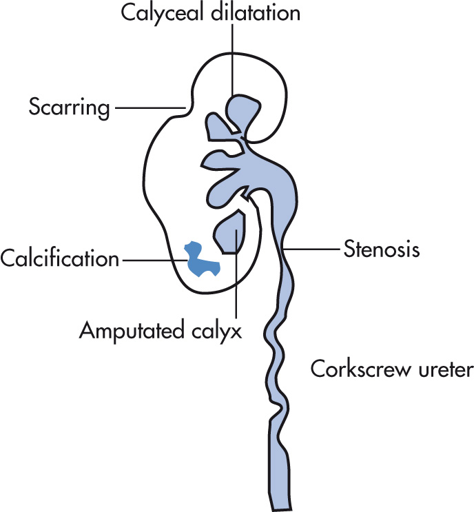 FIG. 4.7