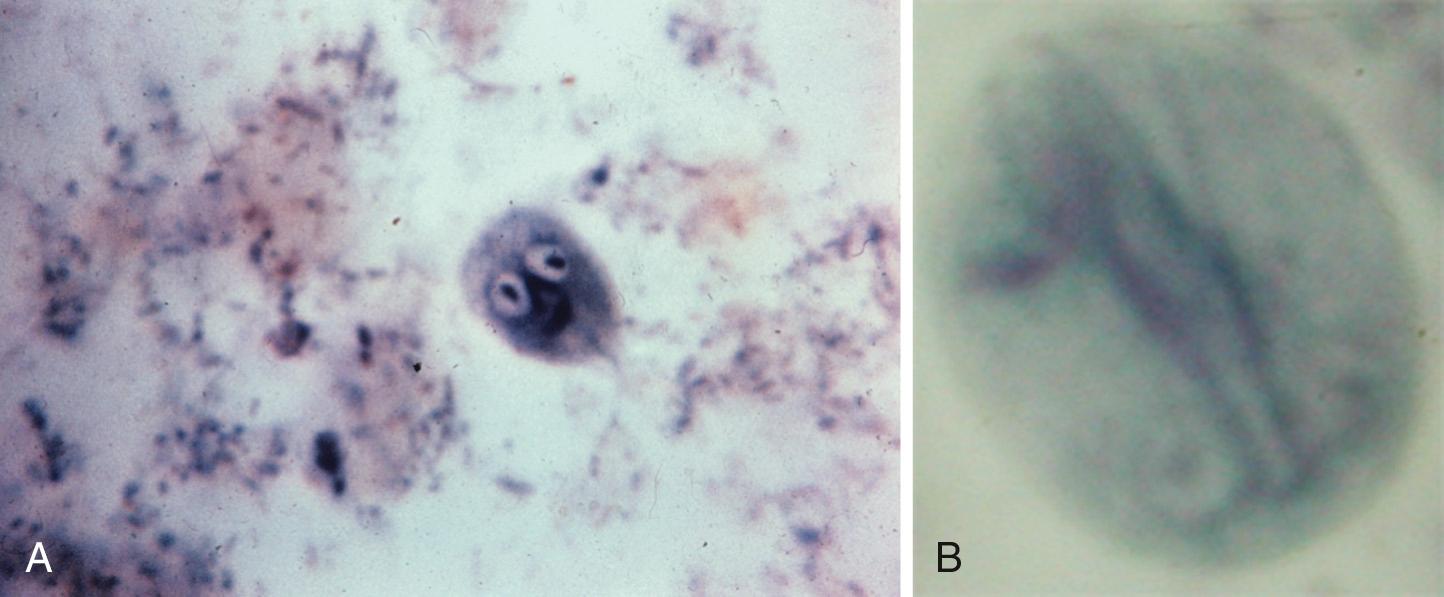 FIG. 279.1, Giardia lamblia trophozoite (A) and cyst (B) are demonstrated in a trichrome stain of fecal material.