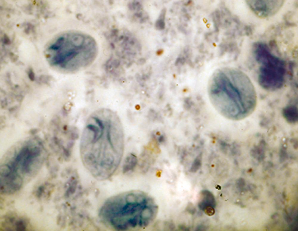 FIGURE 322-2, Iron hematoxylin stain of Giardia lamblia cysts from stool.