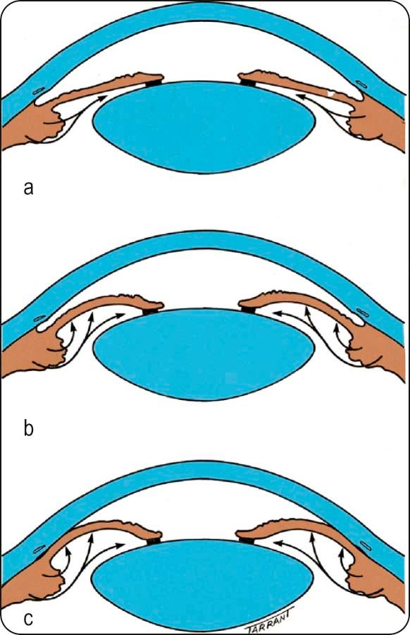 Fig 10.3