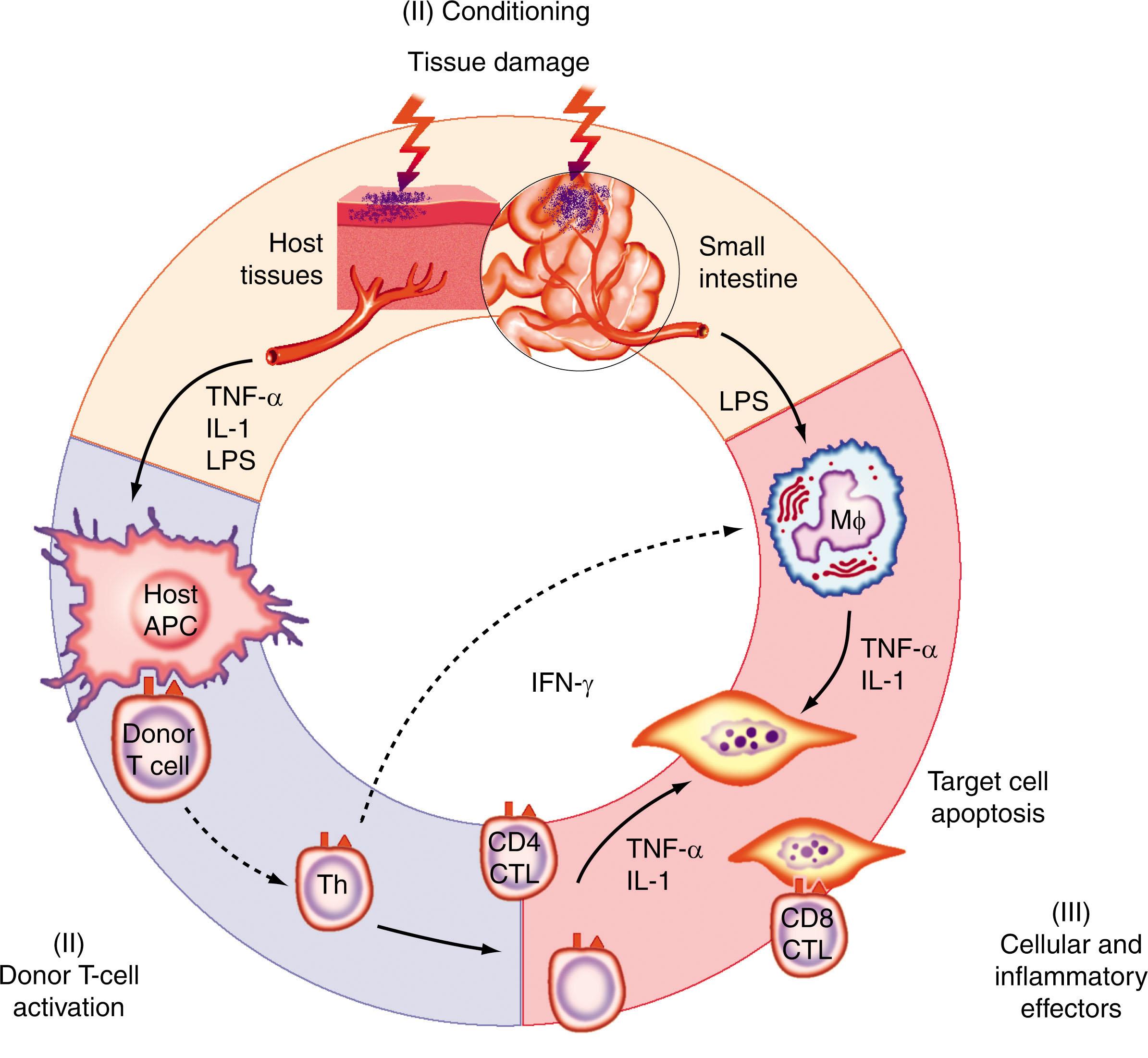 Figure 109.2, PATHOPHYSIOLOGY OF GRAFT-VERSUS-HOST DISEASE.