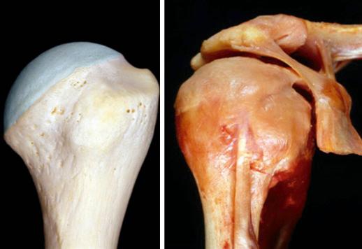 FIG. 29.3, Bony and soft-tissue anatomy of proximal humerus, including lesser and greater tuberosities. Left: Bony landmarks of greater tuberosity and their relation to humeral head height. Right: The rotator cuff insertions on the greater and lesser tuberosities. The long head of the biceps tendon defines the landmark between both tuberosities.