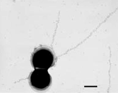 Figure 12-1, Immunogold labeling and transmission electron microscopy of group B streptococcal organisms showing long pilus-like structures extending from the cell surface.