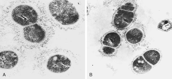 Figure 12-2, Electron micrographs of thin sections of type Ia group B streptococcal prototype strains. A, Type Ia strain 090. B, Type Ia/c strain A909. Both are stained with ferritin-conjugated type Ia–speciﬁc rabbit antibodies. The larger capsule is representative of those found also in Lanceﬁeld prototype II strain (18RS21) and type III isolates from infants with meningitis, whereas the smaller capsule is representative of that also found on Lanceﬁeld prototype strain Ib (H36B).