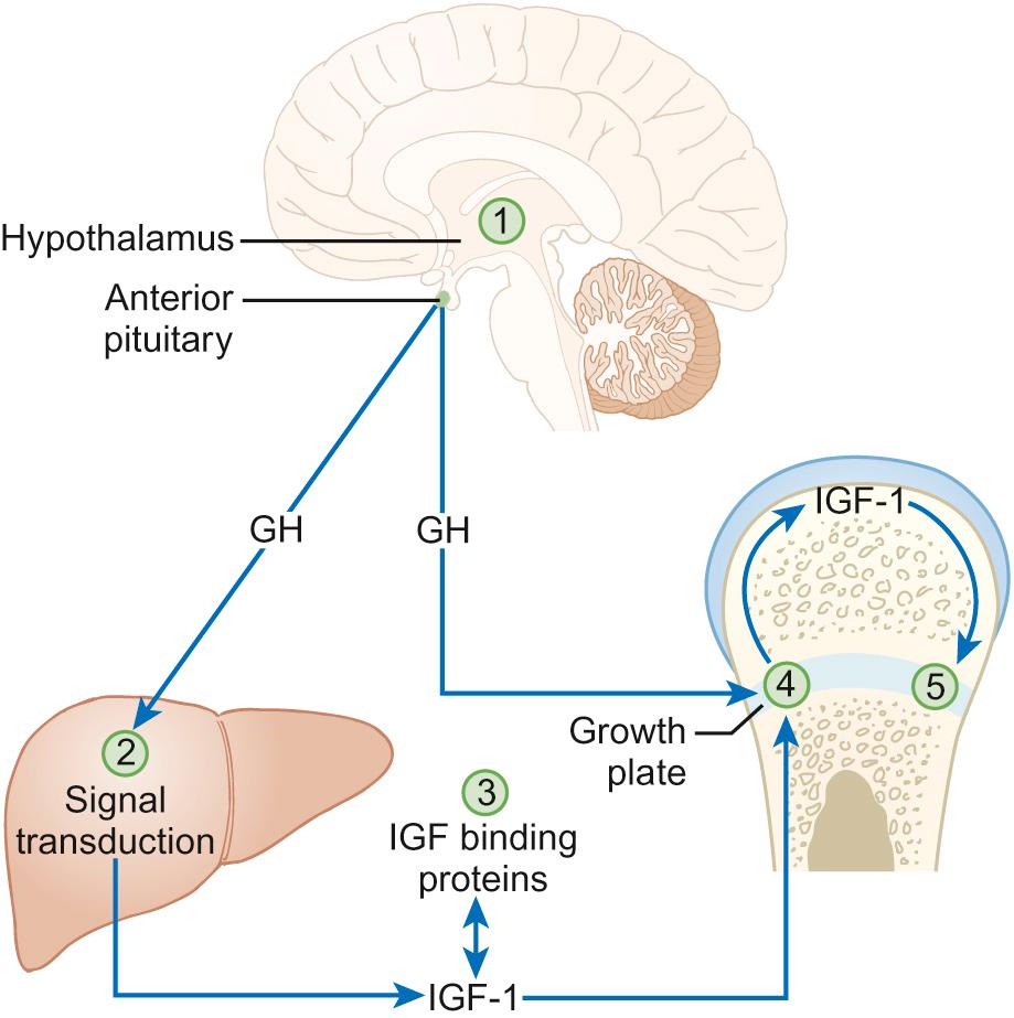 Fig. 12.1, The growth hormone/IGF-1 axis. Cytokines act on (1) appetite centres in the brain affecting appetite and calorie intake; (2) growth hormone signal transduction in the hepatocyte; (3) proteolysis of IGFBP-3; (4) IGF-1 expression in the growth plate; (5) proliferation of growth plate chondrocytes. GH, growth hormone; IGF, insulin-like growth factor.