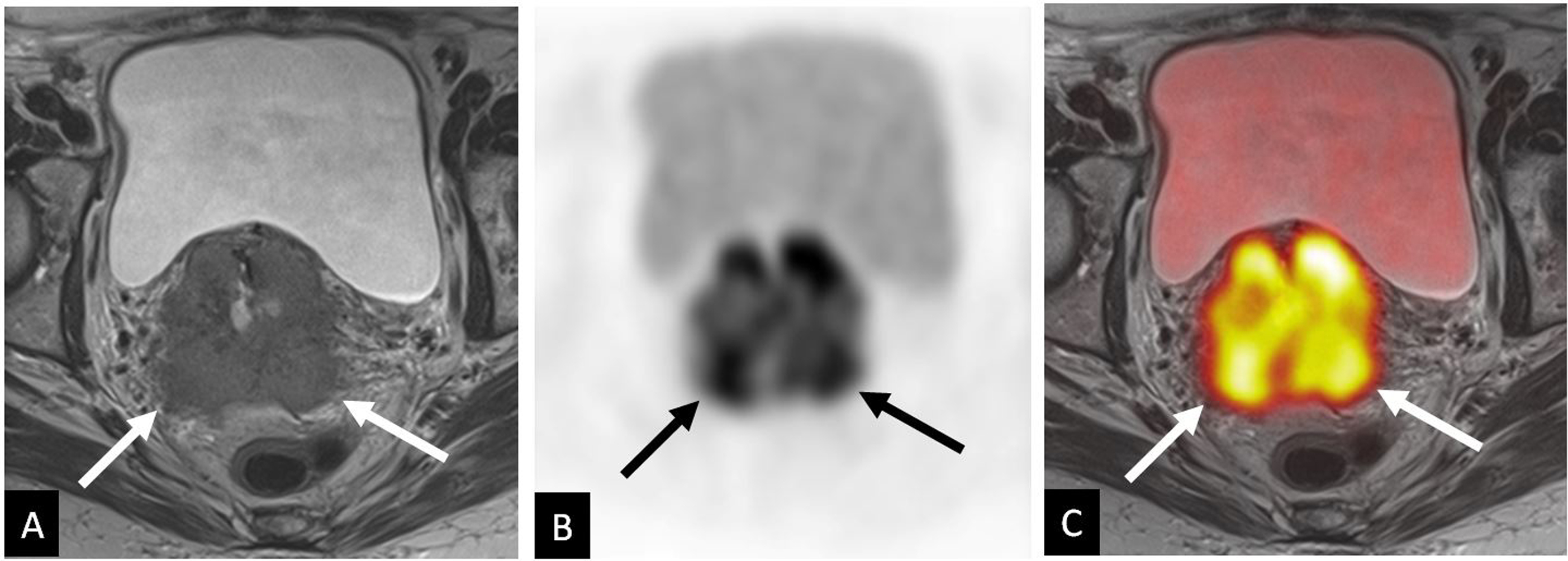 Gynecologic imaging - Clinical Tree