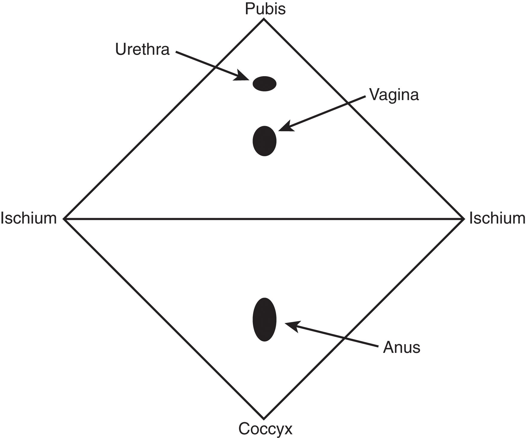 FIGURE 1, Schematic diagram of the female perineum.