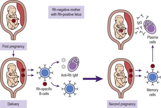 FIGURE 19-1, Pathogenesis of rhesus alloimmunization.