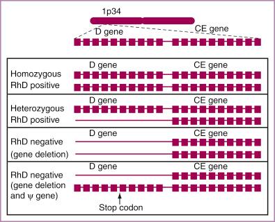 • Fig. 40.1, Schematic diagram of the Rhesus (Rh) gene locus on chromosome 1. The four genotypes are shown: homozygous Rh(D) positive, heterozygous Rh(D) positive, typical Rh(D) negative and the Rh(D) pseudogene (Ψ).