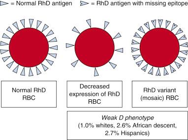 • Fig. 40.2, Weak D: Schematic illustration of the normal Rh(D)-positive and weak D/partial D red blood cells (RBCs).