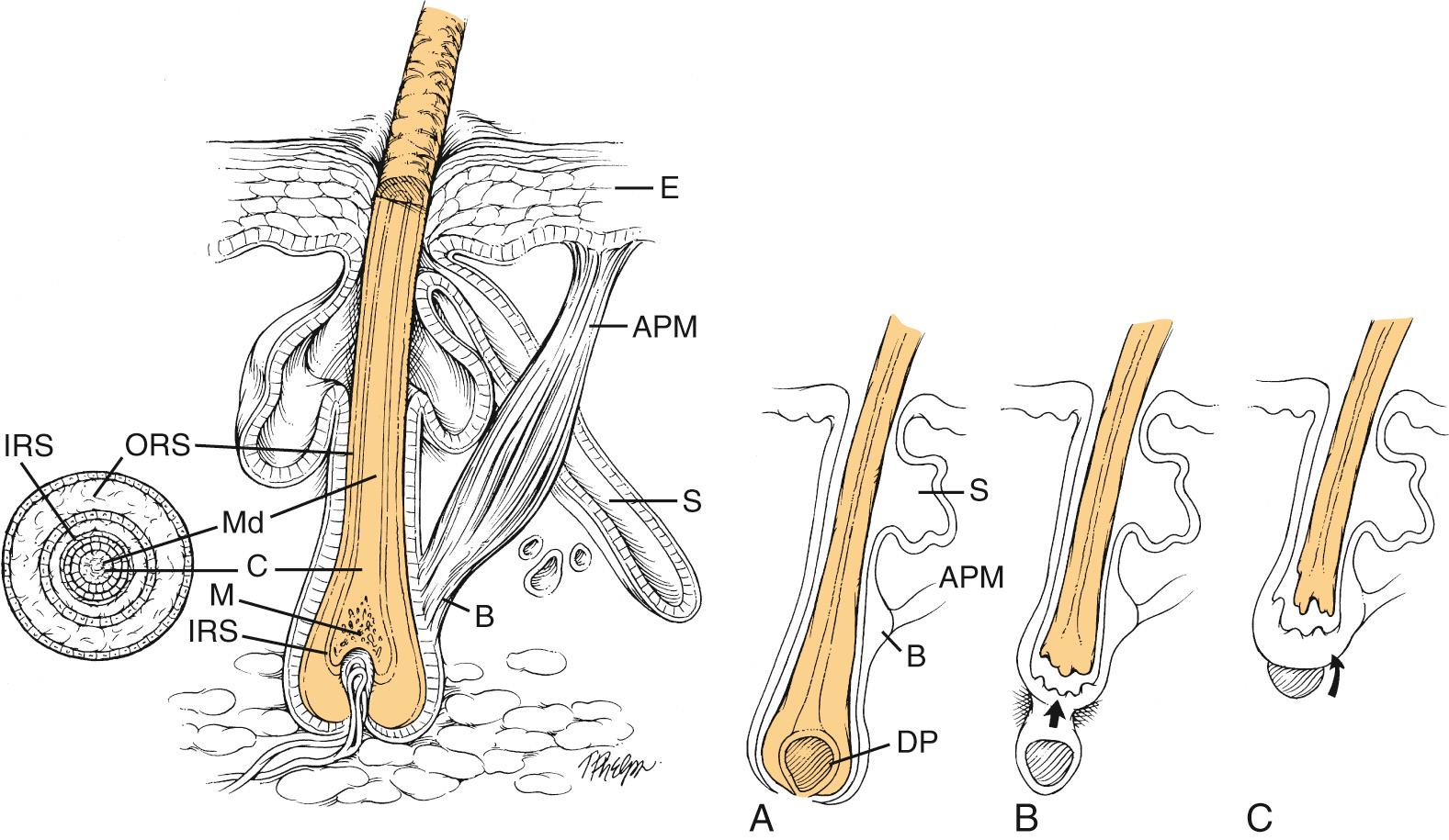 Fig. 22.1, Anatomy of the hair follicle and the different phases of the hair cycle. (A) Anagen. (B) Catagen. (C) Telogen. Labeled structures include the arrector pili muscle (APM) , bulge (B) , cortex (C) , dermal papilla (DP) , epidermis (E) , inner root sheath (IRS) , matrix (M) , medulla (Md) , outer root sheath (ORS) , and sebaceous gland (S) .