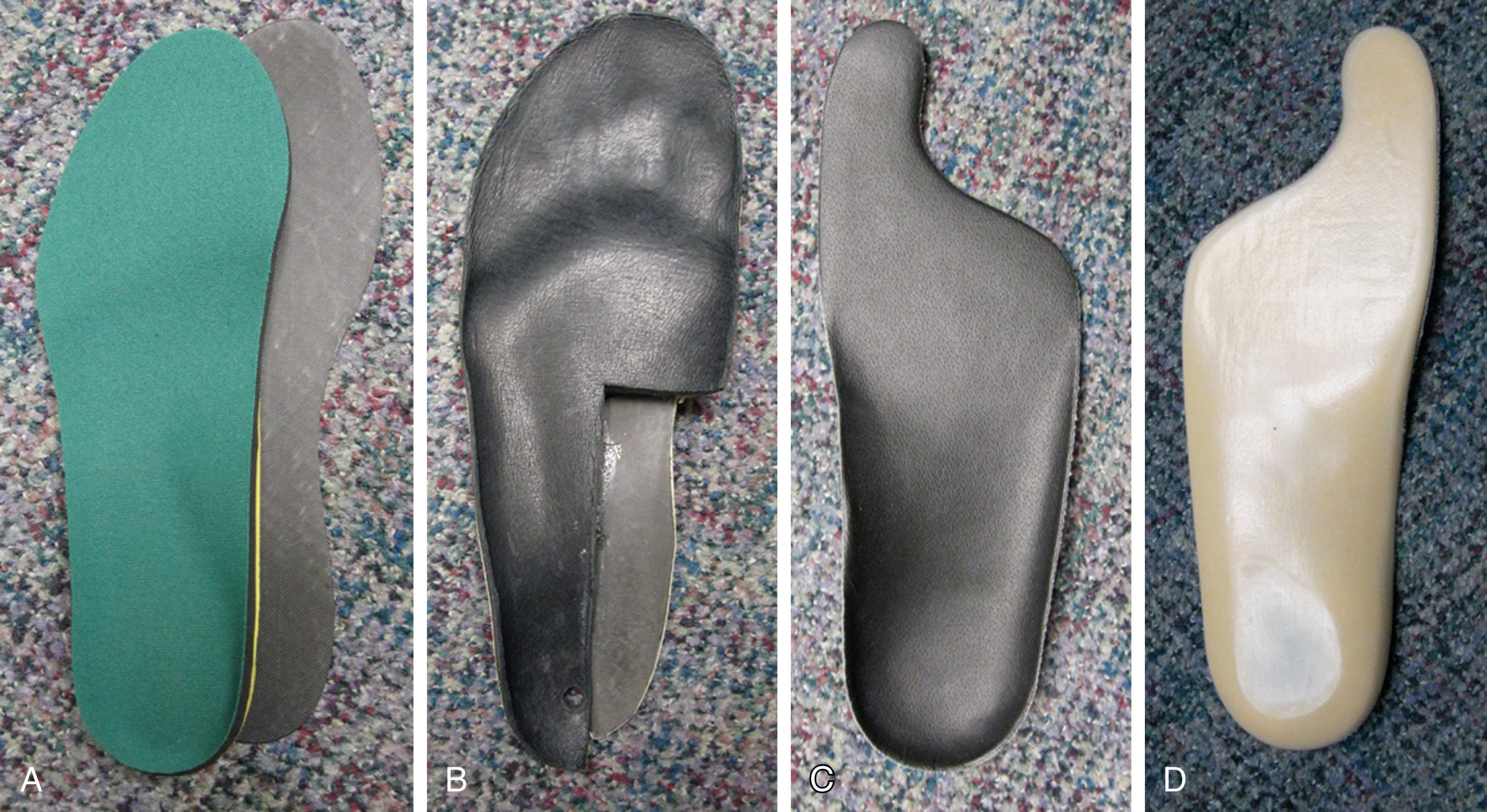 Fig. 27-11, Orthoses for hallux rigidus. A , Soft insole with graphite orthosis beneath, which stiffens entire insole, restricting metatarsophalangeal (MTP) joint excursion. B , Composite orthosis with gel and graphite combined. C , Orthotic with “Morton extension” to restrict MTP joint motion. D , Same orthotic from plantar aspect.